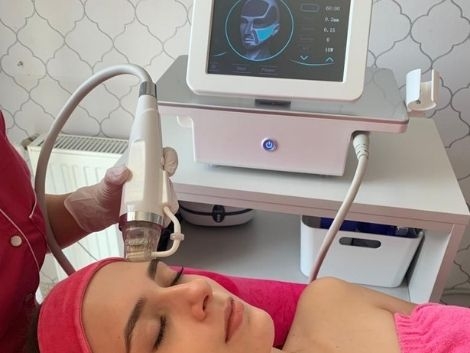 Radiofrekwencja mikroigłowa 